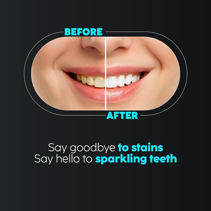 SmiloShine® Charcoal Toothpaste & Bamboo Toothbrush Combo - Before After Teeth